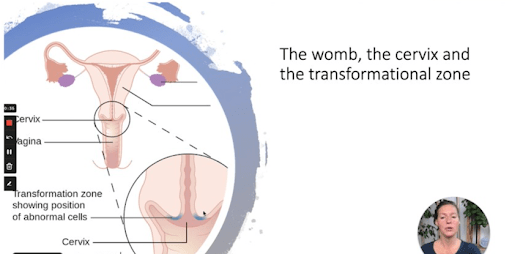 the-womb