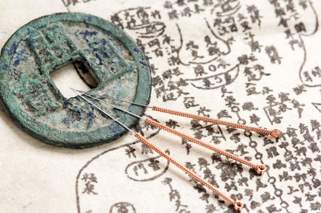 Chinese Medicine acupuncture needles and locations identified on face and body