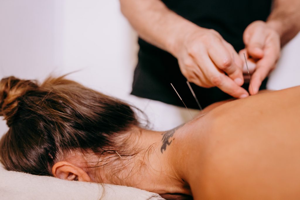 Learn more about acupuncture benefits